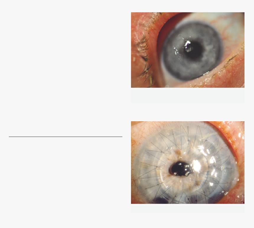 Close-up, HD Png Download