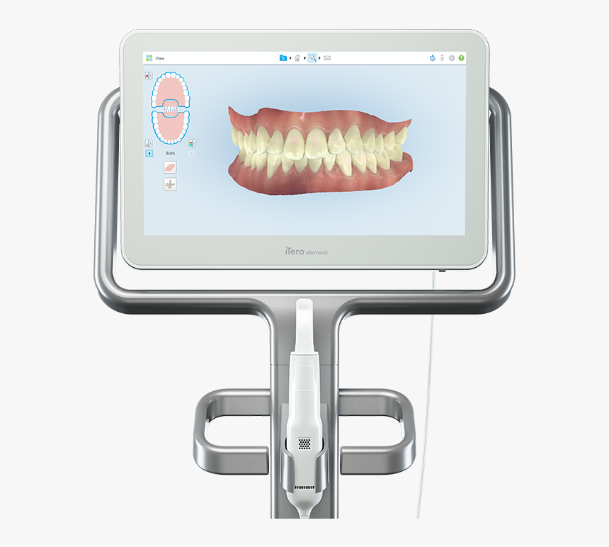 Itero Element 2 Impression Free Scanner - Itero Element 2 Scanner, HD Png Download