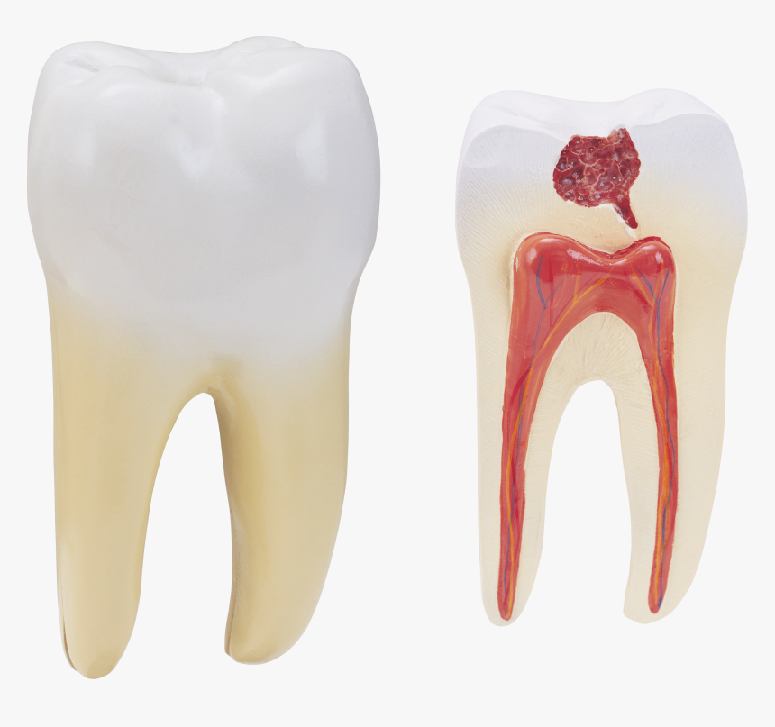 Tooth On A Transparent Background, HD Png Download