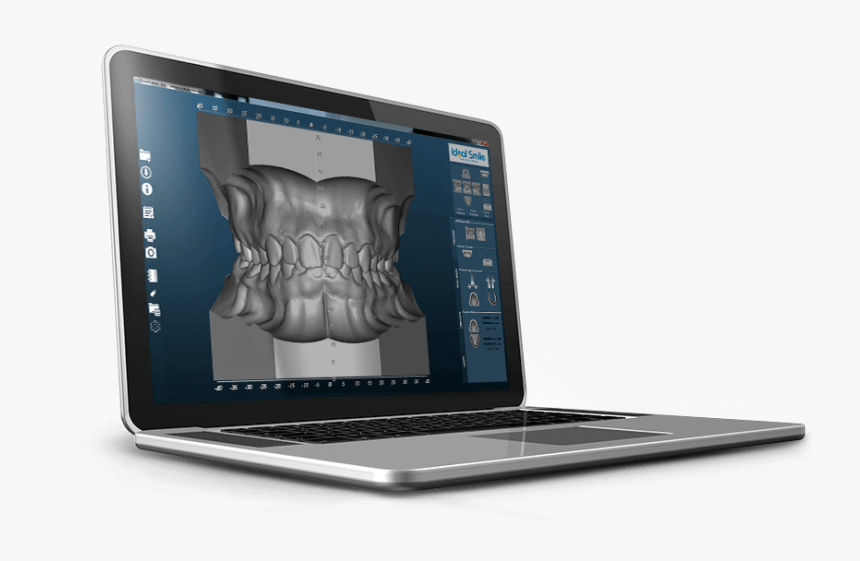 Netbook, HD Png Download