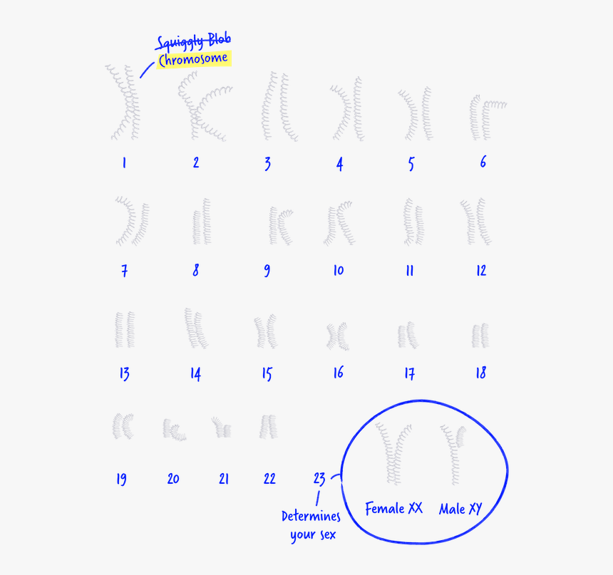 Chromosomes Of Hurler Syndrome, HD Png Download