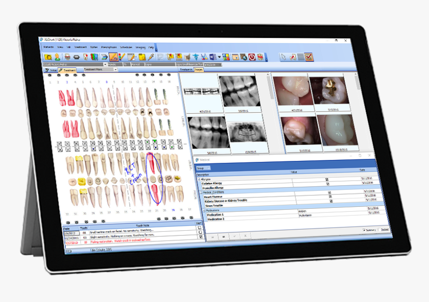 Tablet Mockup 12 19 16 - Medical Practice Management Software, HD Png Download