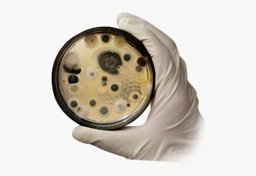 Mold Removal - Image Png - Black Mould Fungus, Transparent Png