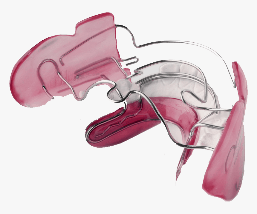 Myofunctional Appliances In Orthodontics, HD Png Download