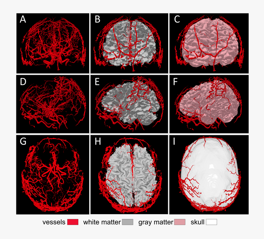 Uni-logo - Computed Tomography, HD Png Download