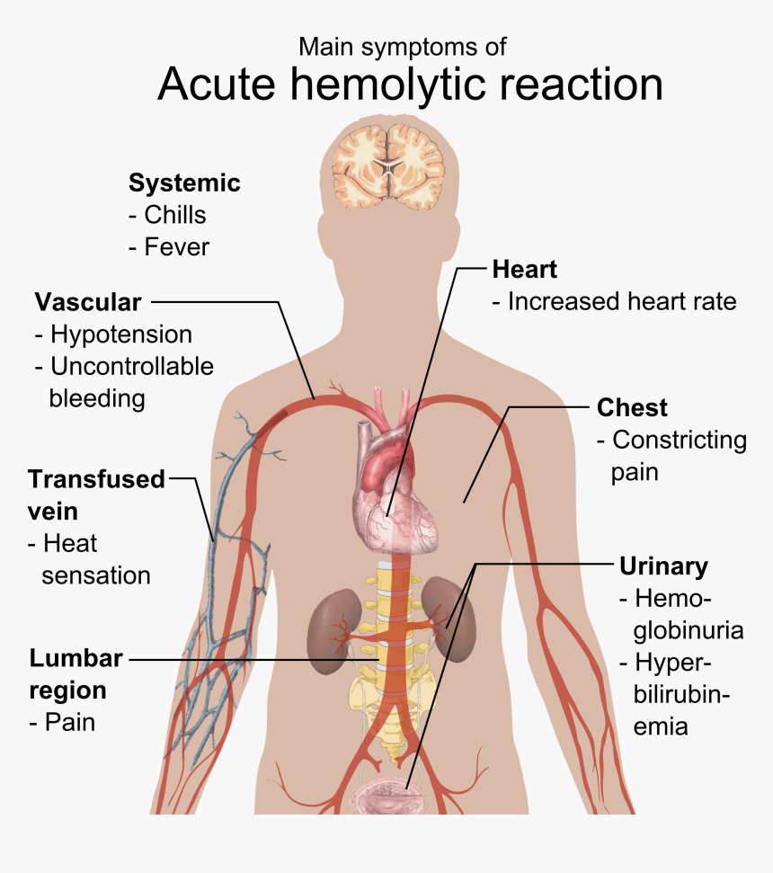 Effects Of Hypothyroidism, HD Png Download