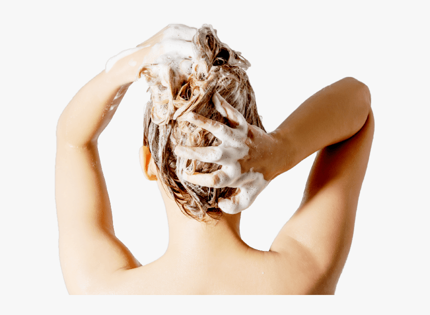 Léger Psoriasis Cuir Chevelu, HD Png Download