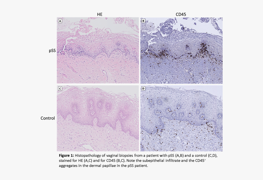 Beschrijving - Beschrijving - Beschrijving - Beschrijving - Mountain, HD Png Download