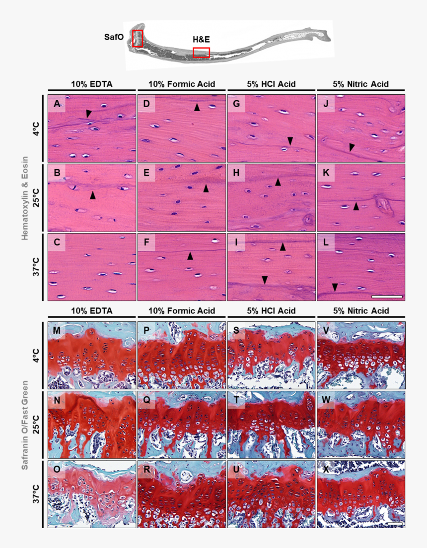 Transparent Sebastian Stan Png - Slope, Png Download