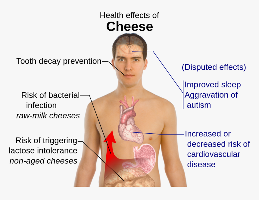 Lactose Intolerance Effects, HD Png Download