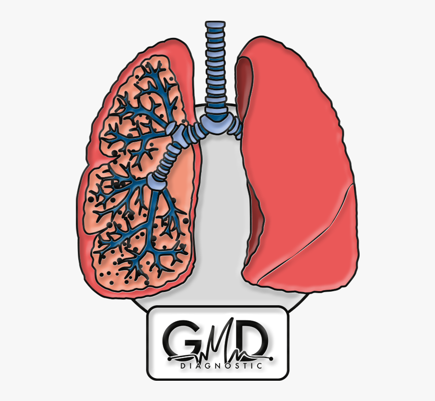 Transparent Pulmones Png - Pines De Pulmon, Png Download