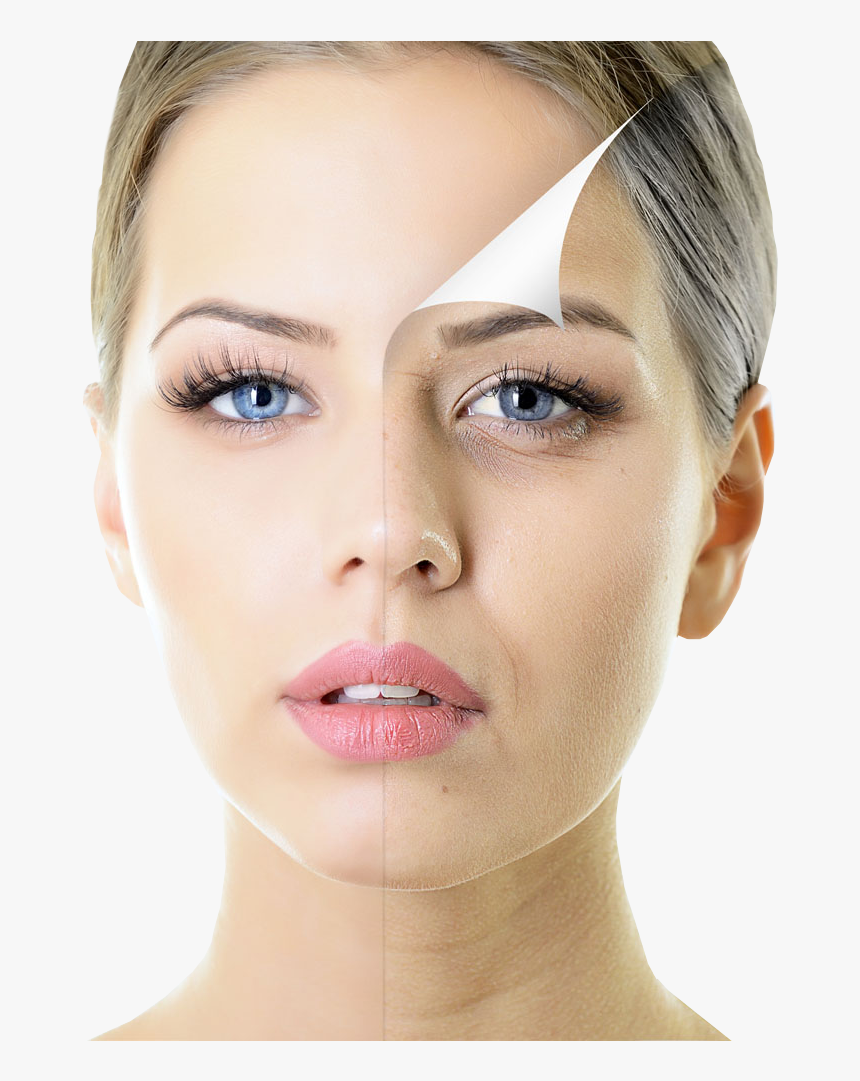 Beautiful Woman With Half Face Spotty Skin , Png Download, Transparent Png