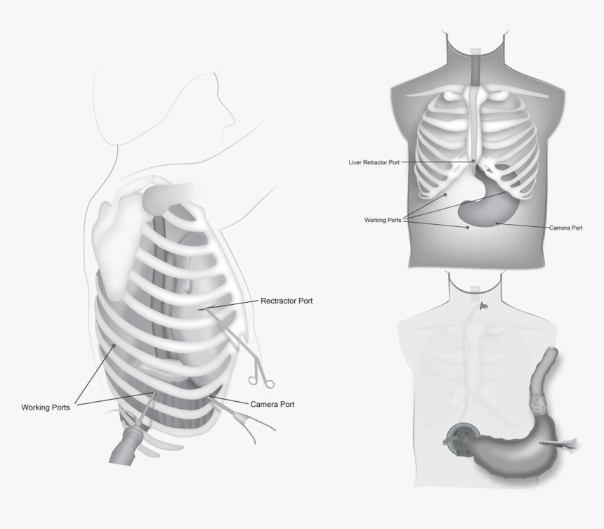Rib , Png Download - Rib, Transparent Png , Transparent Png Image - PNGitem