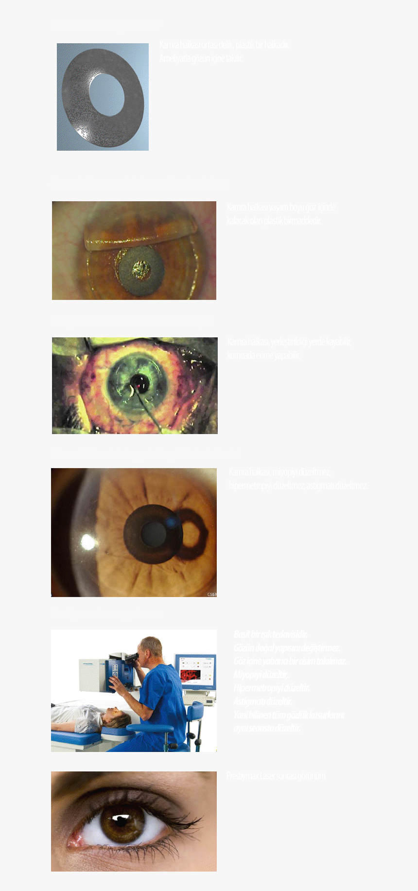 Camera Lens, HD Png Download