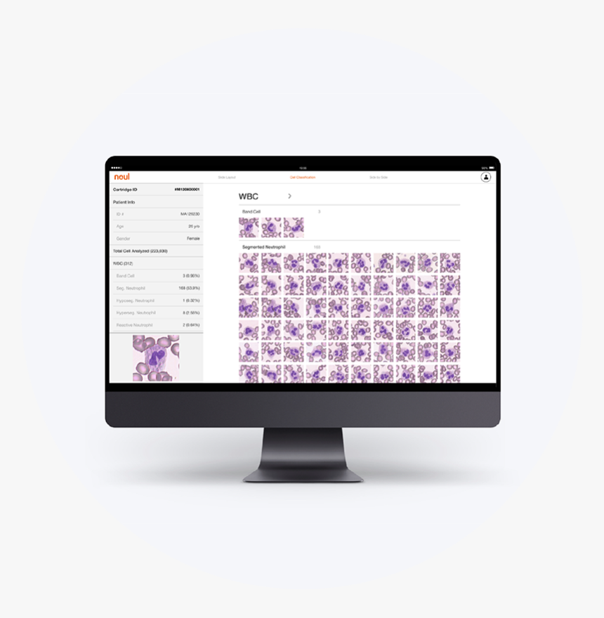Bcma Viewer S - Computer Monitor, HD Png Download