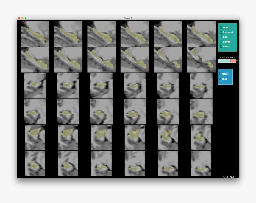 Images/hippocampus Not Zoomed In - Rabbit, HD Png Download