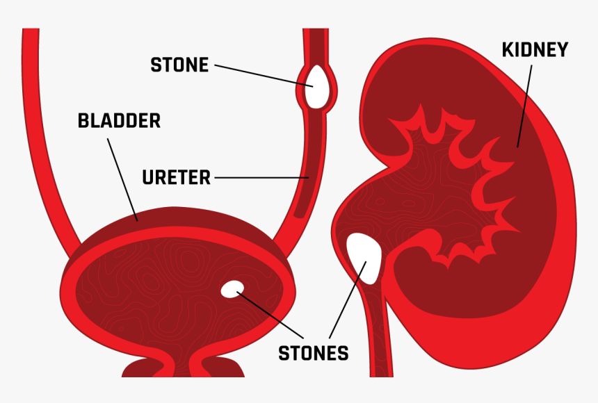 Clip Art Stones Overview Relief Illustration, HD Png Download