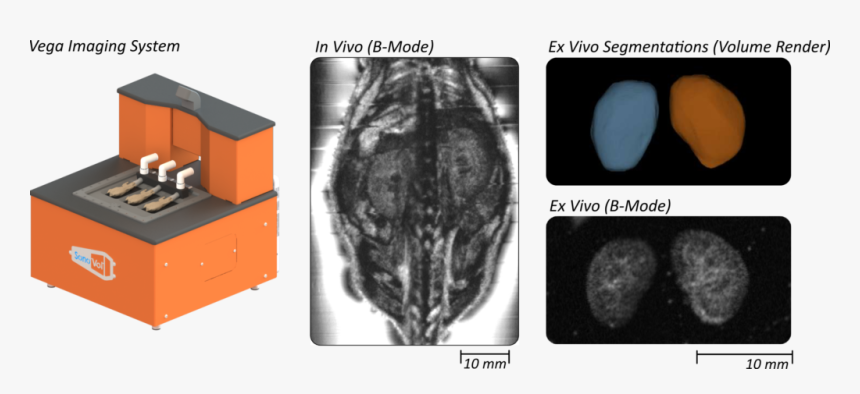 Computed Tomography, HD Png Download