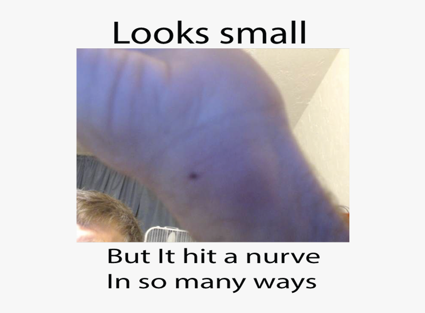 Ouch - Netgear Router Reset Button, HD Png Download