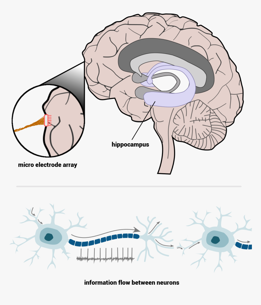 Cross Section Of The Human Brain Micro Electrode Array Brain, HD Png