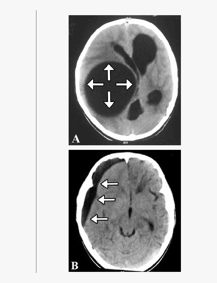 Computed Tomography, HD Png Download