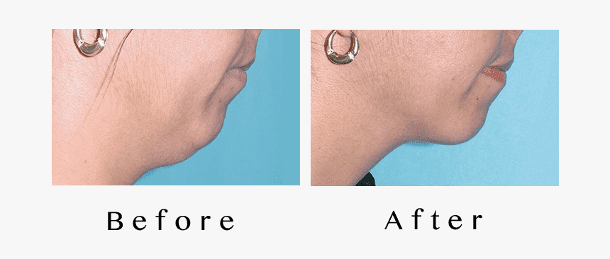 Earrings, HD Png Download