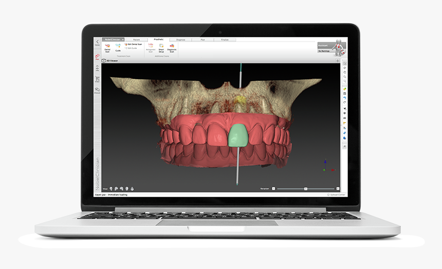 Digital Dentistry Workflow Courses - Netbook, HD Png Download