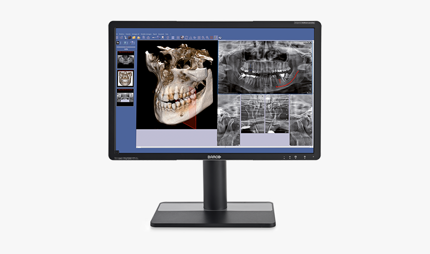 Go 2de3d Nnt Go - Computer Monitor, HD Png Download