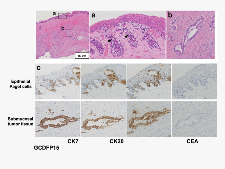 Ck7 Squamous Epithelium, HD Png Download