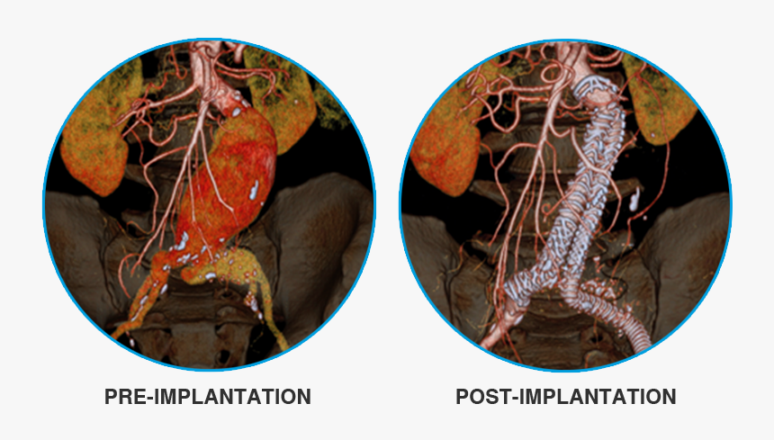 Freshwater Crab, HD Png Download