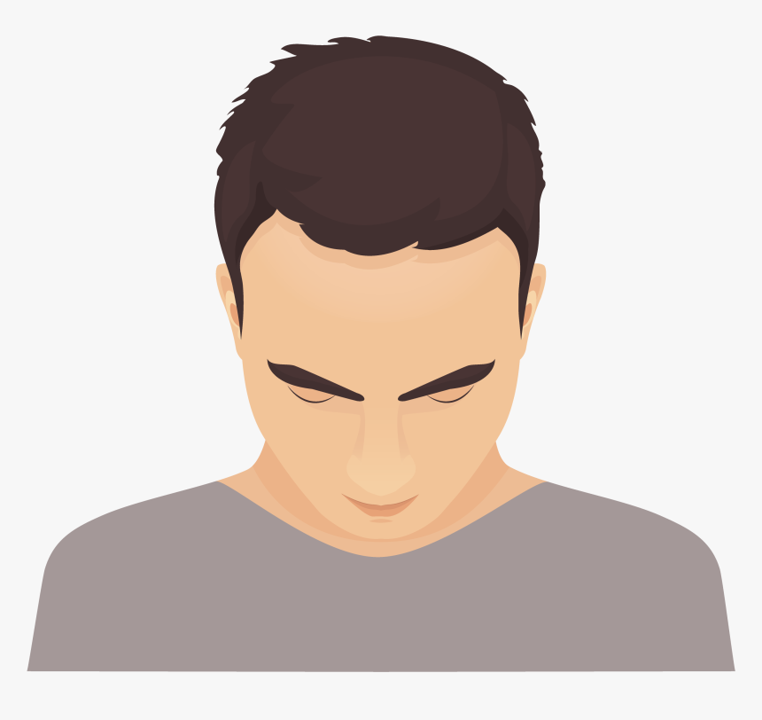 Hair Follicle Transplant Fue, HD Png Download