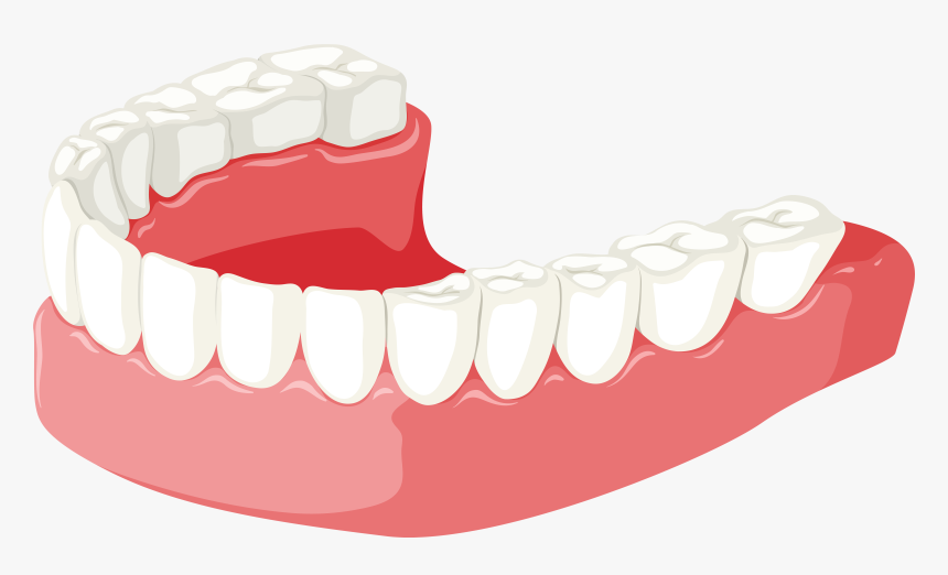 Lower Jaw Png Clip Art - Dentures Clipart, Transparent Png