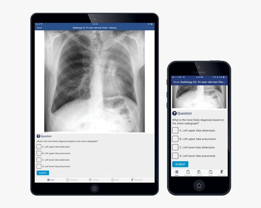 Module - Title - X-ray, HD Png Download