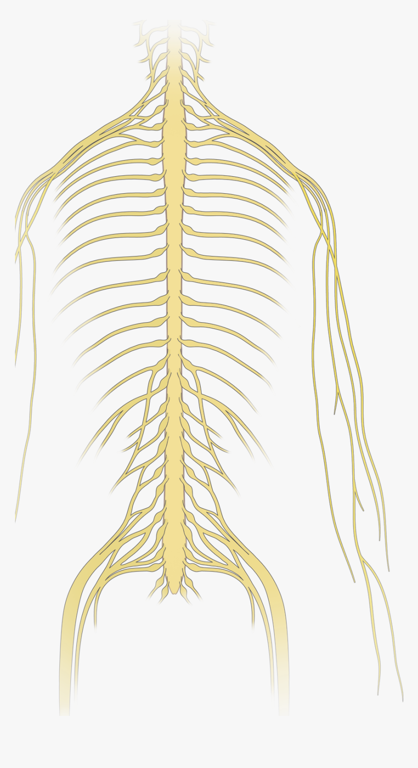 Neoplastic Epidural Spinal Cord Compression Nejm - Drawing, HD Png Download