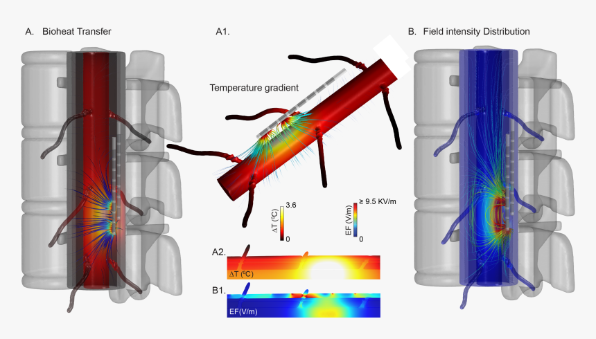 Spinal Cord , Png Download - Spinal Cord Stimulation Field, Transparent Png