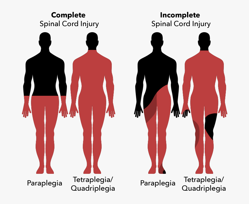 Types Of Spinal Cord Injury, HD Png Download