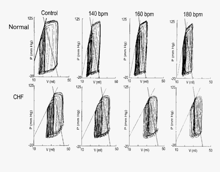 Sketch, HD Png Download