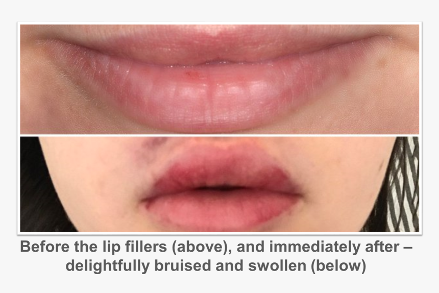 Lip Gloss, HD Png Download