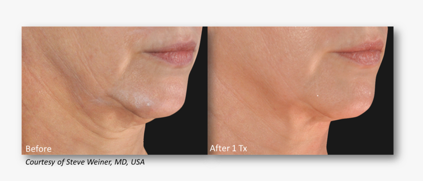 Flesh, HD Png Download