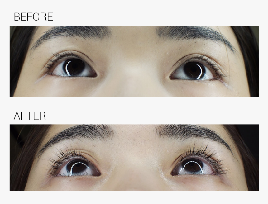 Xlash Eyelash Serum Review, HD Png Download