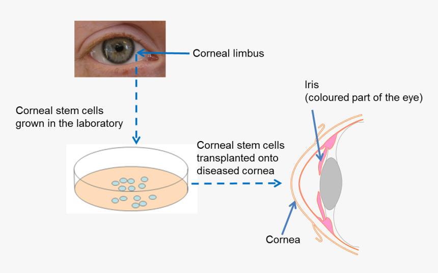 Diagram On Repairing The Cornea - Holoclar Stem Cell, HD Png Download