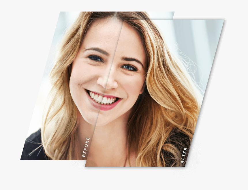 Touch Up, HD Png Download