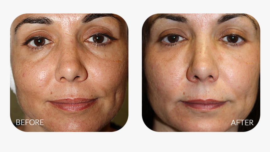 Bronze, HD Png Download