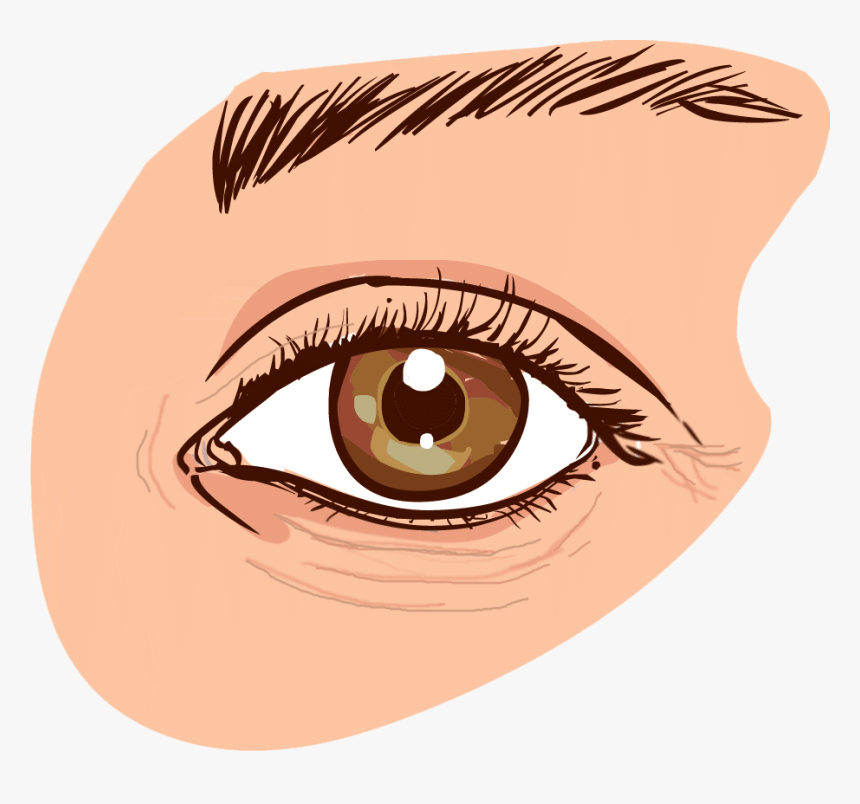 Eye-wrinkles - Causes Dark Circles Eye, HD Png Download