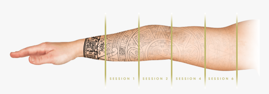 Tri Beam Tattoo Removal Results, HD Png Download