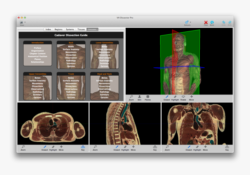 Vh Dissector, HD Png Download