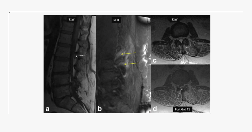 Screenshot, HD Png Download