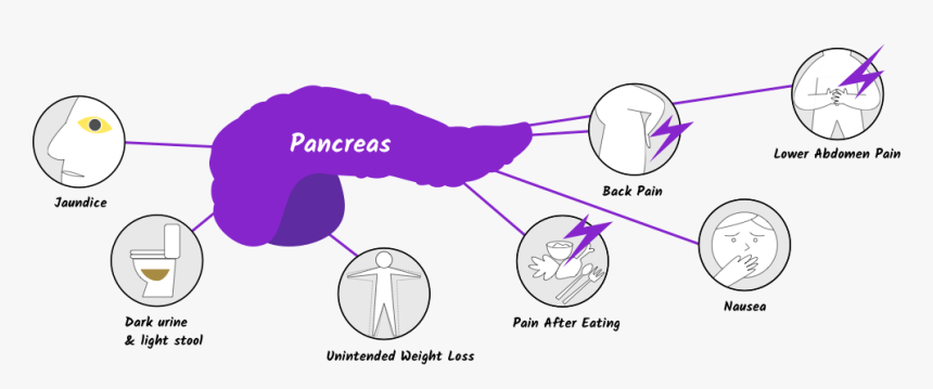 Pancreatic Cancer Symptoms, HD Png Download