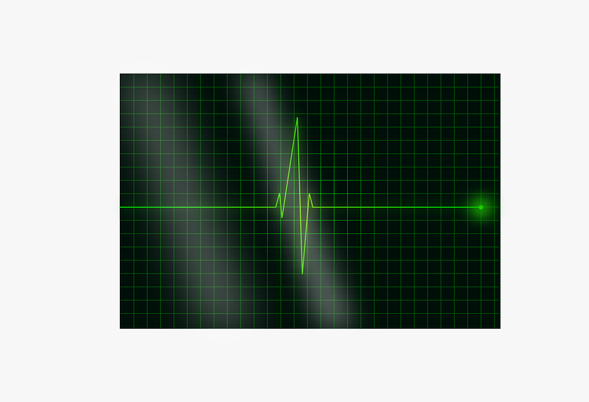 Heartbeat, Pulse, Heart, Signal, Ekg, Electrocardiogram - Laser, HD Png Download