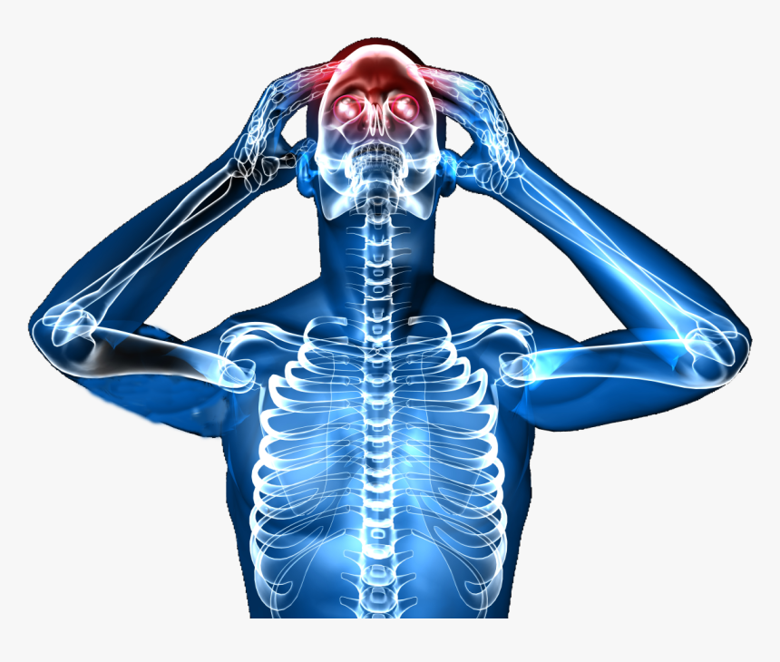Headache , Png Download - Xray Man, Transparent Png